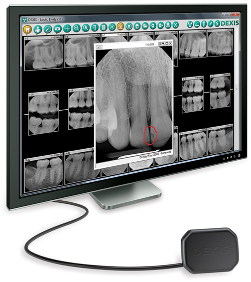 Digital XRays Cosmetic and General Dentistry Boyett Family Dentistry