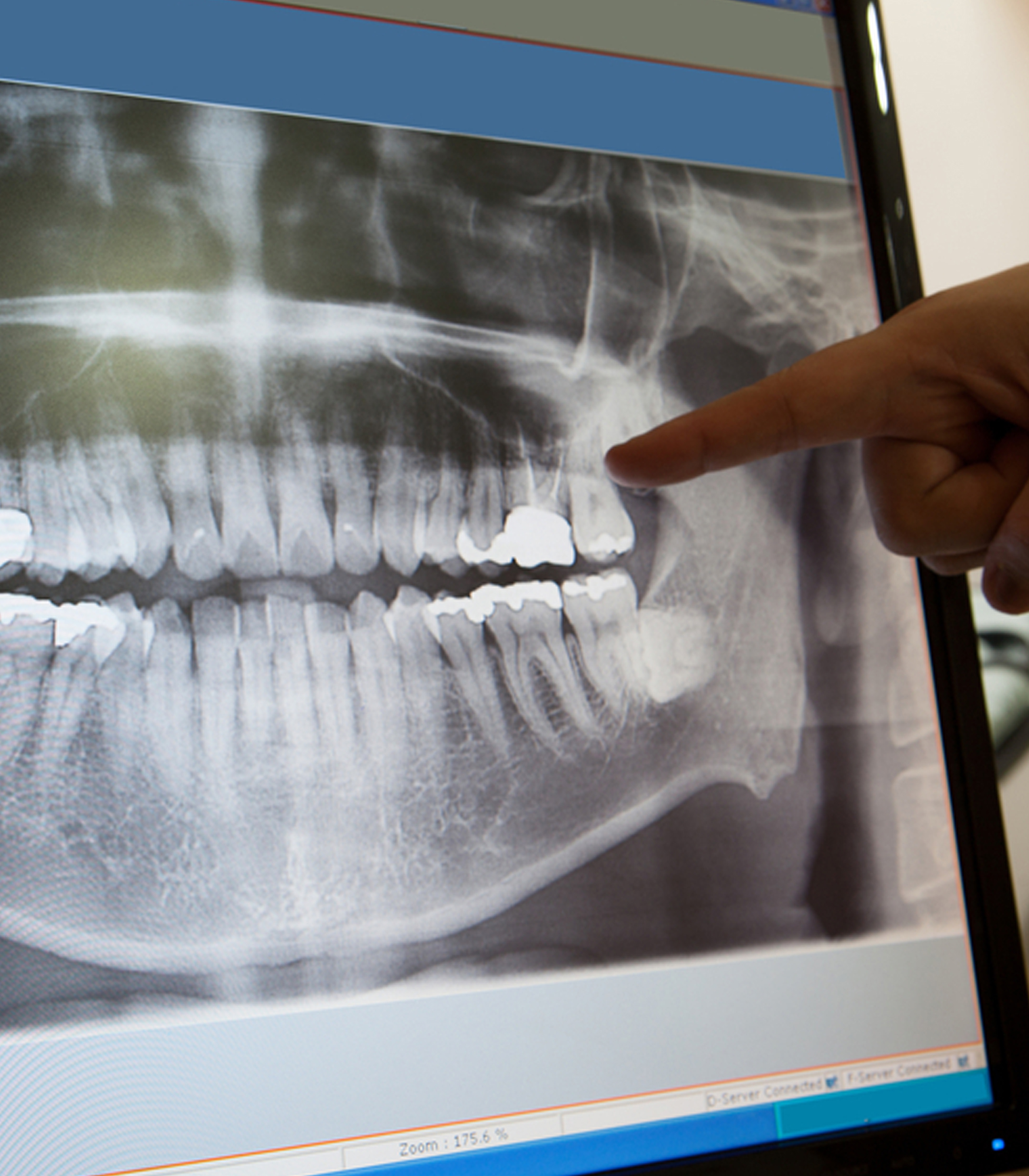 exam and x-rays