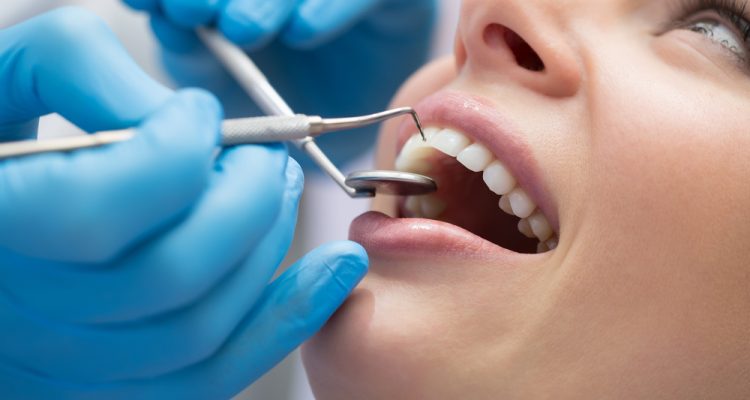 What Are Craze Lines? - Boyett Family Dentistry