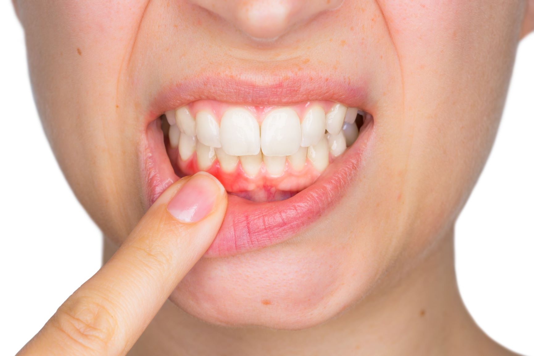 What To Do When Your Teeth Hurt Bad